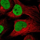 Immunofluorescent staining of human cell line U-2 OS shows localization to nucleoplasm.