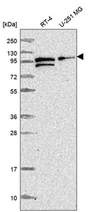 Western blot analysis in human cell line RT-4 and human cell line U-251 MG.