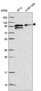Western blot analysis in human cell line RT-4 and human cell line U-251 MG.