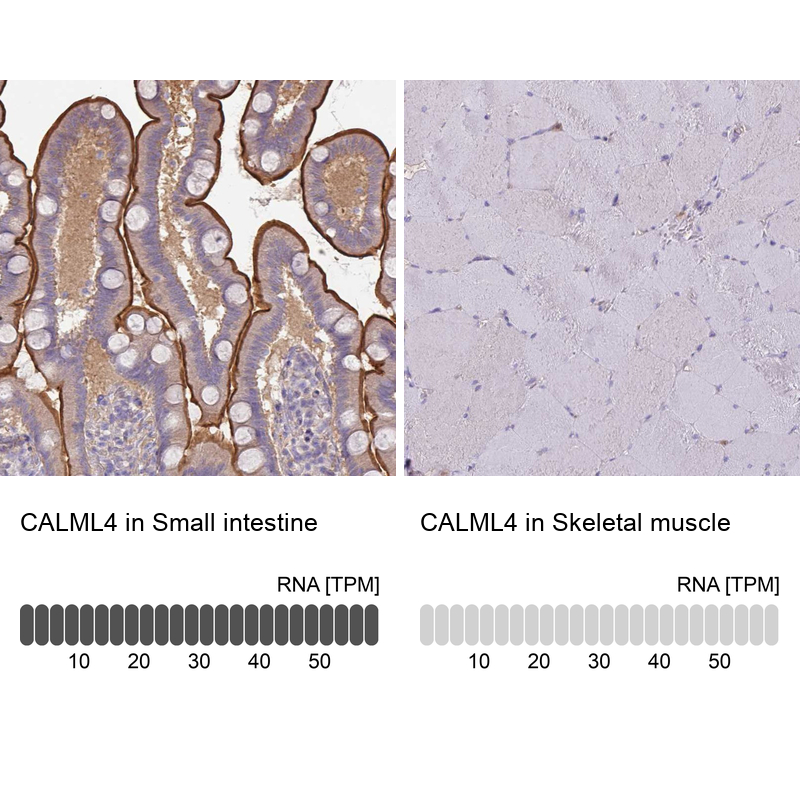 Anti-CALML4 Antibody