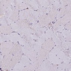 Immunohistochemical staining of human skeletal muscle shows low expression as expected.