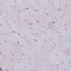 Immunohistochemical staining of human skeletal muscle shows low expression as expected.