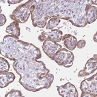 Immunohistochemical staining of human placenta shows moderate granular cytoplasmic positivity in trophoblastic cells.