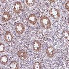 Immunohistochemical staining of human rectum shows moderate granular cytoplasmic positivity in glandular cells.