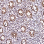 Immunohistochemical staining of human rectum shows moderate granular cytoplasmic positivity in glandular cells.