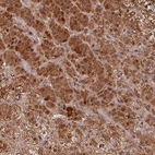 Anti-EID1 Antibody