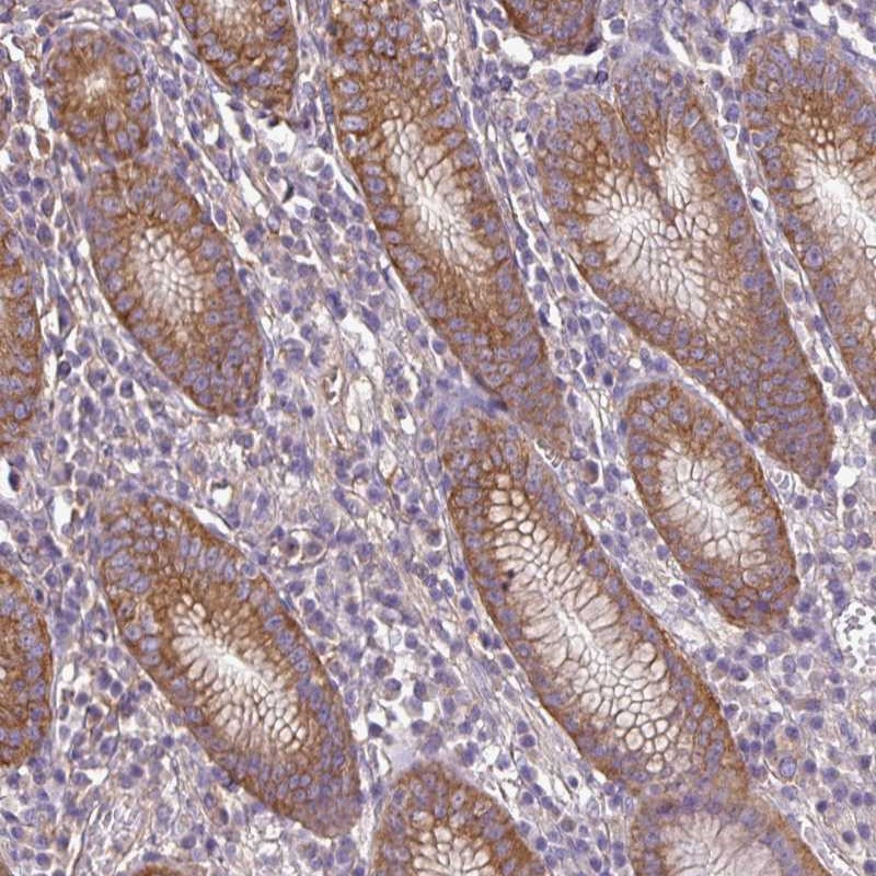 Anti-RP11-849H4.2 Antibody