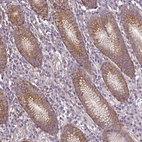 Anti-RP11-849H4.2 Antibody