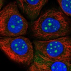 Immunofluorescent staining of human cell line HaCaT shows localization to nucleoli.