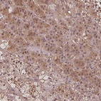 Anti-EID1 Antibody