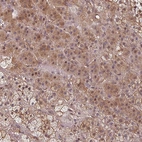 Anti-EID1 Antibody