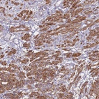 Anti-TIAF1 Antibody