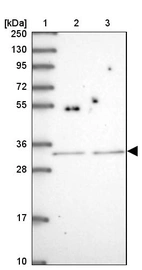 Lane 1: Marker [kDa] 250, 130, 95, 72, 55, 36, 28, 17, 10_br/_Lane 2: Human cell line RT-4_br/_Lane 3: Human cell line U-251MG sp