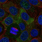 Immunofluorescent staining of human cell line MCF7 shows localization to cytosol.