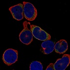 Anti-IGLL1 Antibody