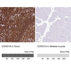 Immunohistochemistry analysis in human tonsil and skeletal muscle tissues using HPA051132 antibody. Corresponding CORO1A RNA-seq data are presented for the same tissues.
