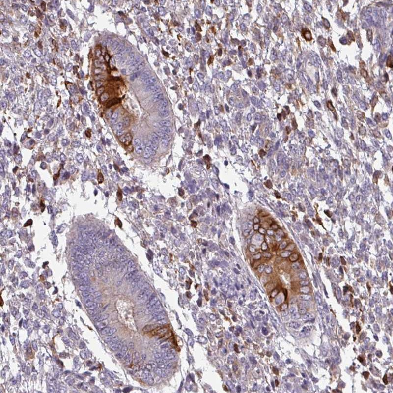 Anti-ZNF835 Antibody