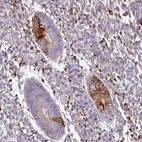 Anti-ZNF835 Antibody
