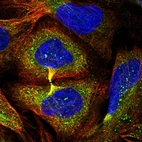 Immunofluorescent staining of human cell line U-2 OS shows localization to microtubules, cytokinetic bridge & vesicles.