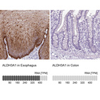 Anti-ALDH3A1 Antibody