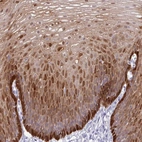 Immunohistochemical staining of human esophagus shows high expression.