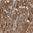 Immunohistochemical staining of human heart muscle shows strong cytoplasmic positivity in cardiomyocytes.