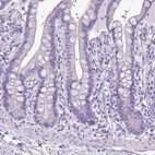 Immunohistochemical staining of human colon shows low expression as expected.