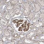 Immunohistochemical staining of human kidney shows strong membranous and cytoplasmic positivity in cells in glomeruli.