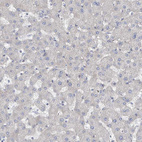 Anti-KANK3 Antibody