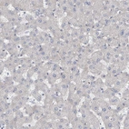 Immunohistochemical staining of human liver shows no positivity in hepatocytes.