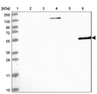 Lane 1: Marker [kDa] 250, 130, 95, 72, 55, 36, 28, 17, 10_br/_Lane 2: Human cell line RT-4_br/_Lane 3: Human cell line U-251MG sp_br/_Lane 4: Human plasma (IgG/HSA depleted)_br/_Lane 5: Human liver tissue_br/_Lane 6: Human tonsil tissue