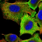 Immunofluorescent staining of human cell line A549 shows localization to plasma membrane & cytosol.