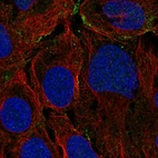 Immunofluorescent staining of human cell line U-2 OS shows localization to plasma membrane.