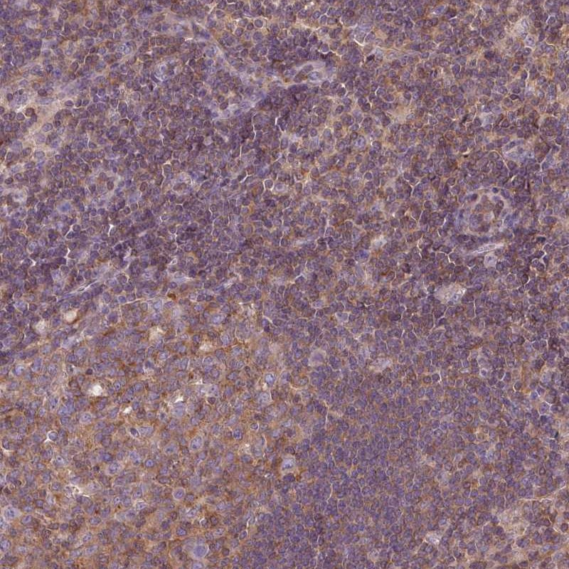 Anti-STAT5A Antibody