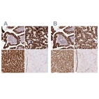Immunohistochemical staining of human gastrointestinal, kidney, liver and skeletal muscle using Anti-PCK2 antibody HPA051162 (A) shows similar protein distribution across tissues to independent antibody HPA053502 (B).