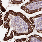 Immunohistochemical staining of human duodenum shows strong granular cytoplasmic positivity in glandular cells.