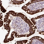 Immunohistochemical staining of human duodenum shows strong granular cytoplasmic positivity in glandular cells.