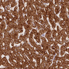 Immunohistochemical staining of human liver shows strong granular cytoplasmic positivity in hepatocytes.
