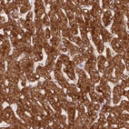 Immunohistochemical staining of human liver shows strong granular cytoplasmic positivity in hepatocytes.