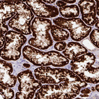 Immunohistochemical staining of human kidney shows strong granular cytoplasmic positivity in cells in tubules.