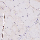 Immunohistochemical staining of human skeletal muscle shows no positivity in myocytes as expected.