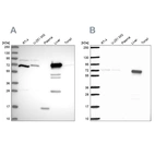 Western blot analysis using Anti-PCK2 antibody HPA051162 (A) shows similar pattern to independent antibody HPA053502 (B).