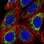 Immunofluorescent staining of human cell line MCF7 shows localization to mitochondria.