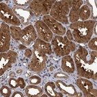 Anti-FBXO6 Antibody