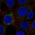 Immunofluorescent staining of human cell line MCF7 shows localization to vesicles.
