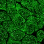 Immunofluorescent staining of human cell line RT4 shows localization to nucleoplasm & cytosol.