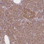 Anti-METRN Antibody