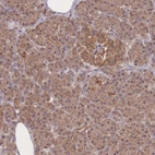 Anti-METRN Antibody