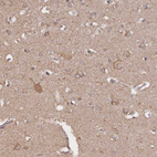 Immunohistochemical staining of human cerebral cortex shows moderate cytoplasmic positivity in neuronal cells and neuropil.