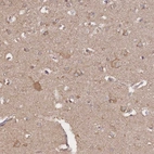 Immunohistochemical staining of human cerebral cortex shows moderate cytoplasmic positivity in neuronal cells and neuropil.